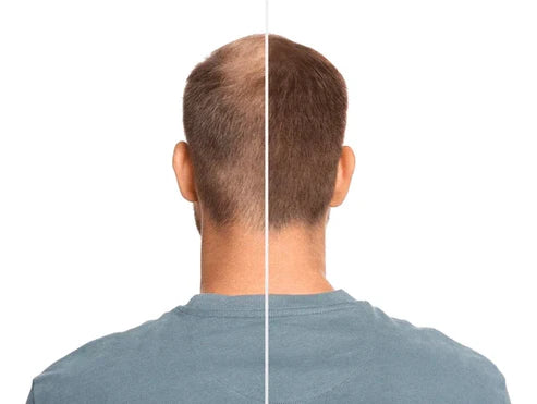 Aceite para nacer cabello y baraba 100%originales Ultimas unidades