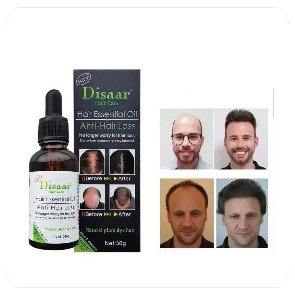 Aceite para nacer cabello y baraba 100%originales Ultimas unidades